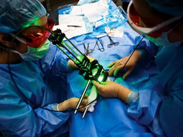 laser treatment laser treatment